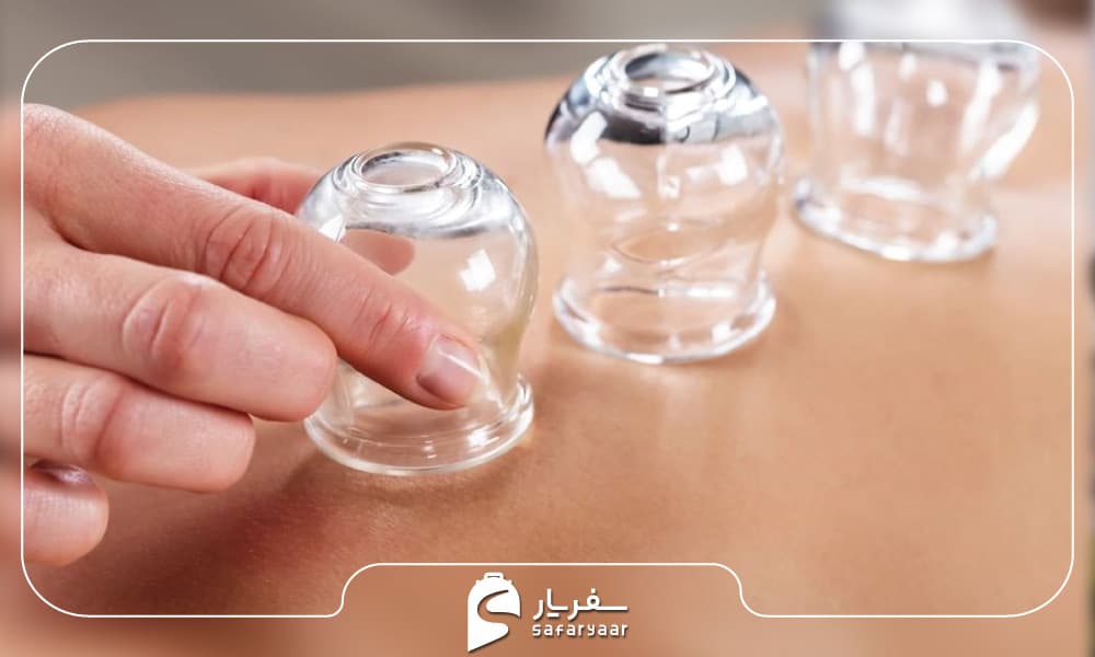 بادکش درمانی یا بادکشگذاری